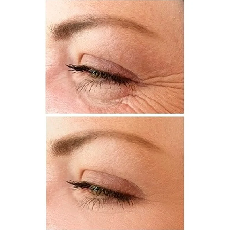 No.1 Lift Øjencreme 15 ml