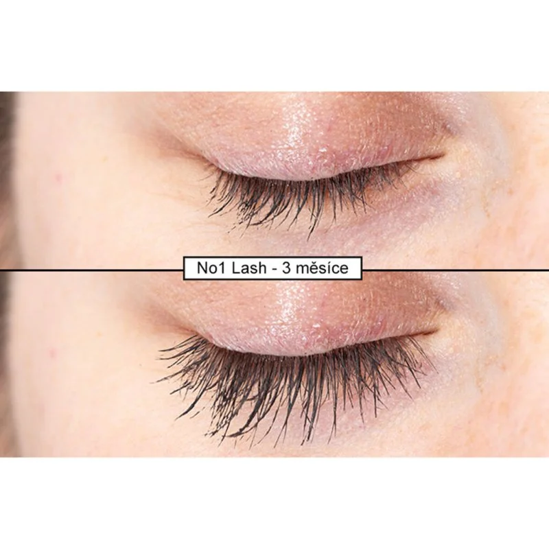 Intensivt Vippeserum 4 ml