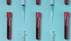 Hvordan man vælger den rigtige kost baseret på blodtype