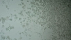 Effektive metoder til at bekæmpe skimmelsvamp på væggen