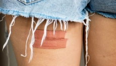 Effektive og naturlige metoder til behandling af betændte sår