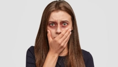 Hvordan man behandler blå mærker med dokumenterede naturlige metoder